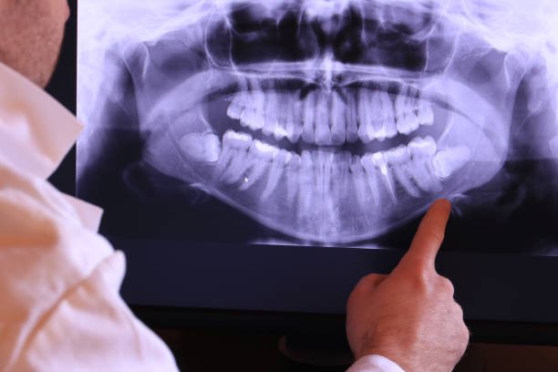 Best Emergency Dental Extractions in Sarand, AL
